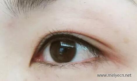 美瞳线不上色是怎么回事