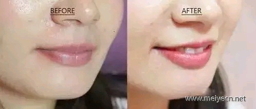 想做漂唇吗？你需要先了解这些问题！
