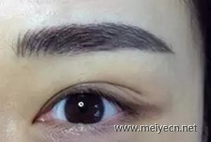 半永久定妆眉术后护理