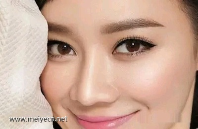 单眼皮做美瞳线好看吗