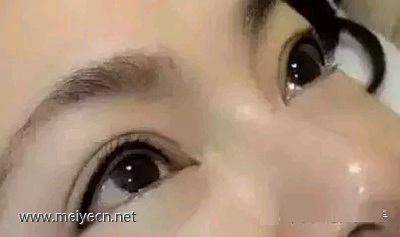 美瞳线