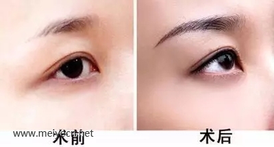 半永久定妆眉