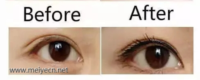 美瞳线